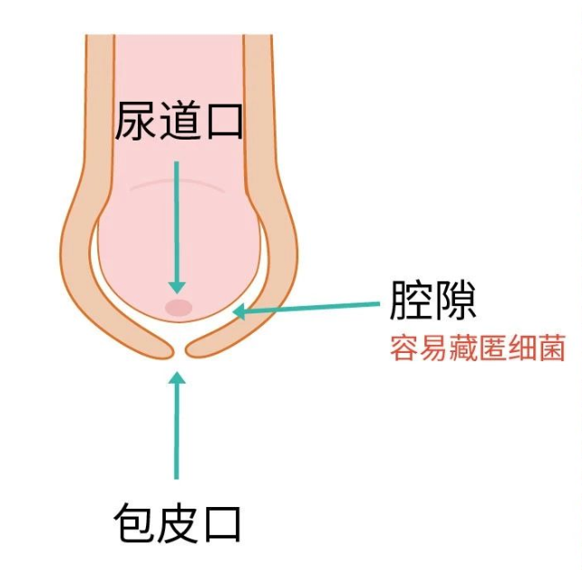 尿道口有针扎似的感觉(图3)