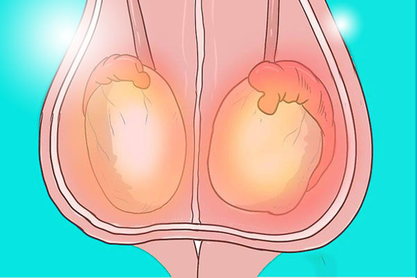 睾丸受伤肿胀怎么办(图2)