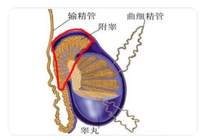 附睾囊肿是怎么引起的(图2)